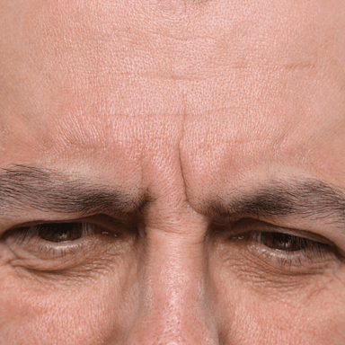 Combination treatments