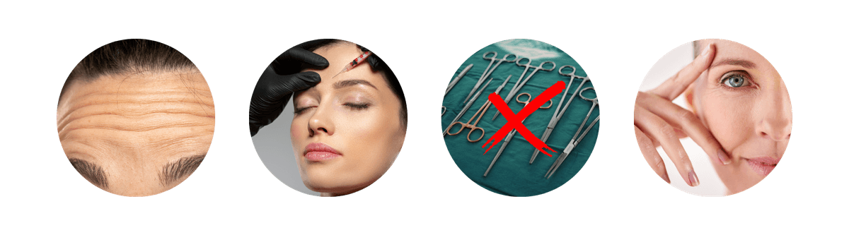 Ideal candidates for forehead botox