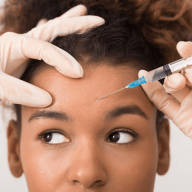 Preventive forehead botox