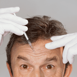 Botox for Forehead Lines
