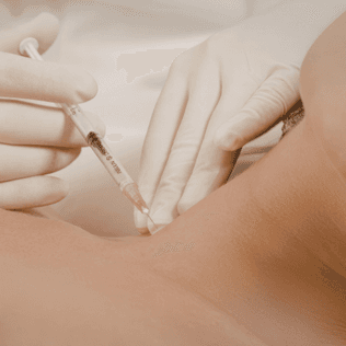 Botox for Neck Wrinkles & Neck Rejuvenation