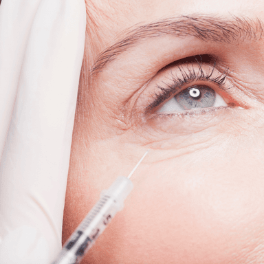 Fine under-eye lines