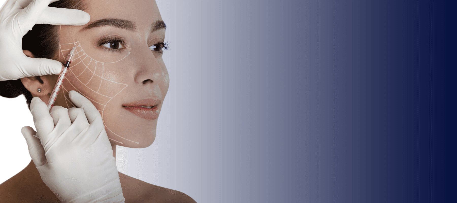 How To Use Botox for Crow's Feet