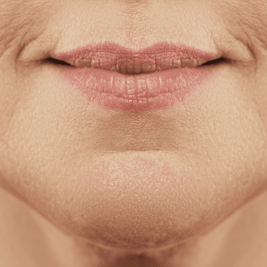 Chin wrinkling