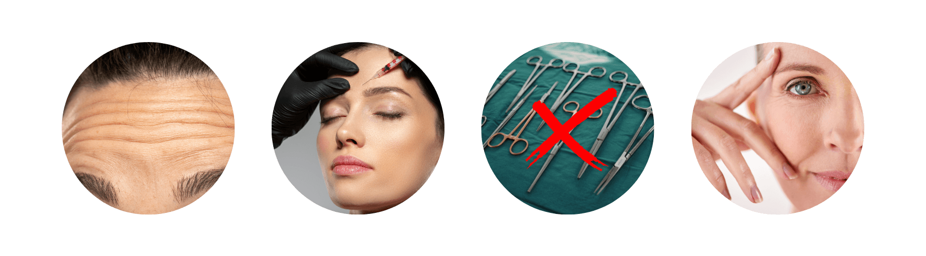Ideal candidates for fine line botox