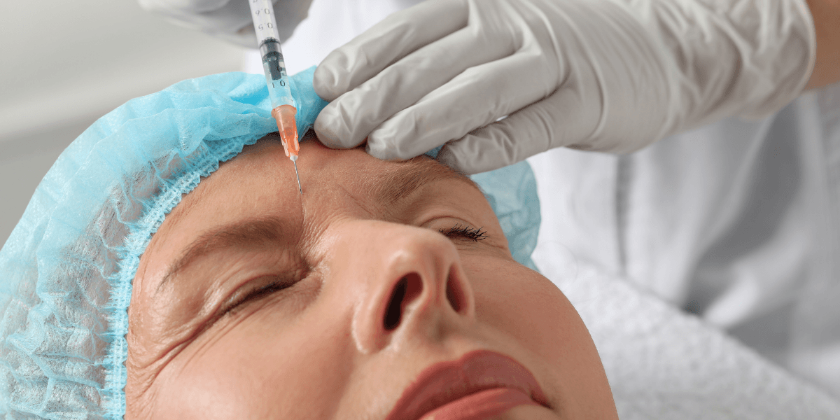 Expected results after glabellar botox