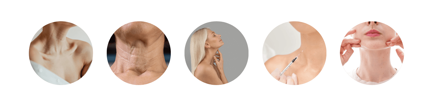 Ideal candidates for neck botox