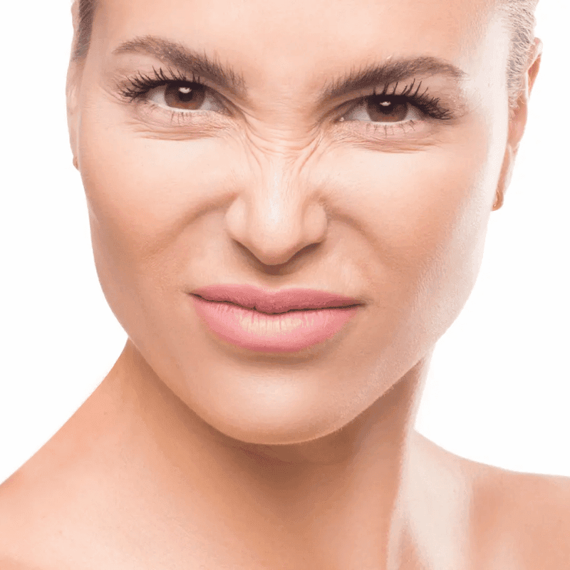 Treatment Guide of Botox for Bunny Lines