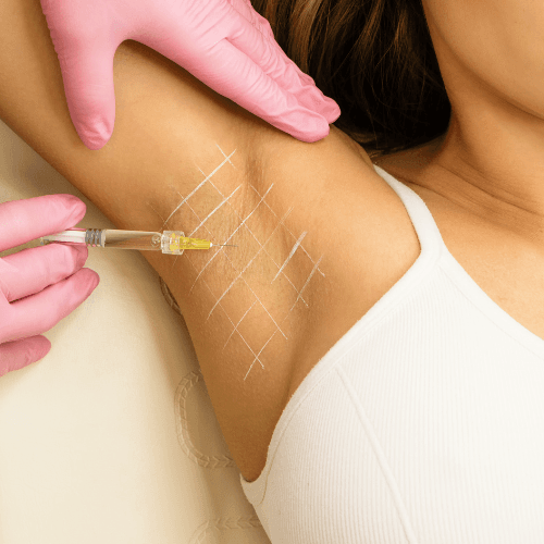 How Botox Helps Control Excessive Sweating