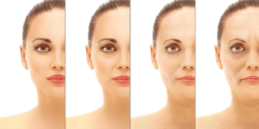 Botox for Facial Aging