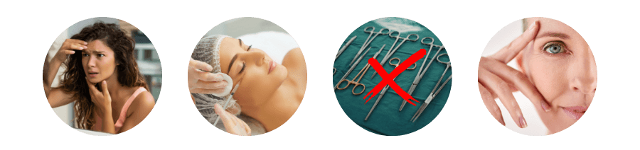 Ideal Candidates for Preventative Botox