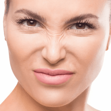 Nose Bridge Wrinkles
