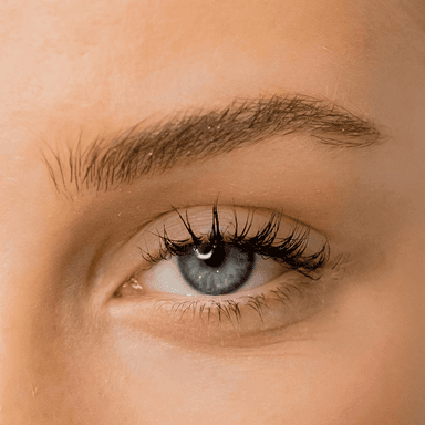 Eyebrow Lift