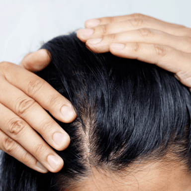 Excessive Sweating in the Face and Scalp