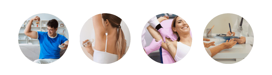Ideal Candidates for Hyperhidrosis Botox