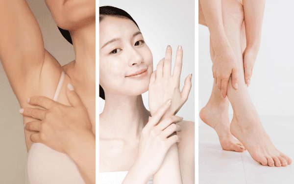 Results are Botox in the Underarms, Hands, and Feet